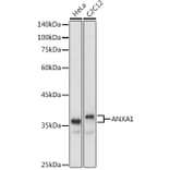 Western Blot - Anti-Annexin A1/ANXA1 Antibody (A8466) - Antibodies.com