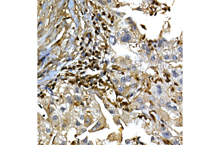 Immunohistochemistry - Anti-Annexin A1/ANXA1 Antibody (A8466) - Antibodies.com