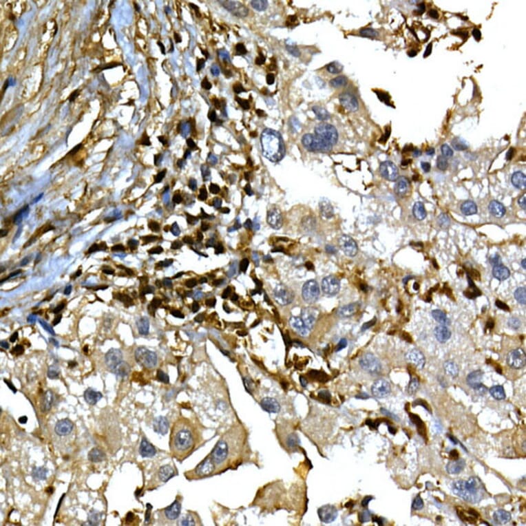 Immunohistochemistry - Anti-Annexin A1/ANXA1 Antibody (A8466) - Antibodies.com
