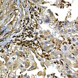 Immunohistochemistry - Anti-Annexin A1/ANXA1 Antibody (A8466) - Antibodies.com