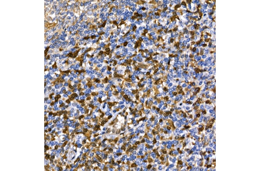 Immunohistochemistry - Anti-Annexin A1/ANXA1 Antibody (A8466) - Antibodies.com
