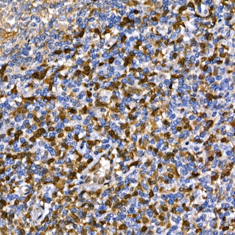Immunohistochemistry - Anti-Annexin A1/ANXA1 Antibody (A8466) - Antibodies.com
