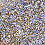 Immunohistochemistry - Anti-Annexin A1/ANXA1 Antibody (A8466) - Antibodies.com