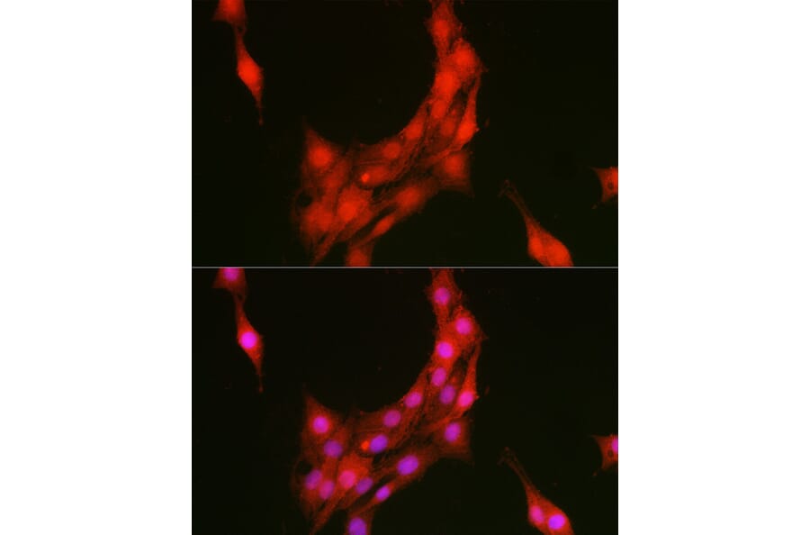 Immunofluorescence - Anti-Annexin A1/ANXA1 Antibody (A8466) - Antibodies.com