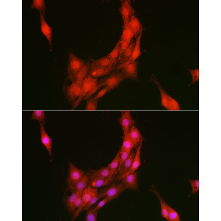 Immunofluorescence - Anti-Annexin A1/ANXA1 Antibody (A8466) - Antibodies.com
