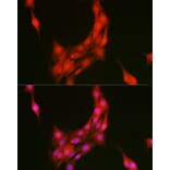 Immunofluorescence - Anti-Annexin A1/ANXA1 Antibody (A8466) - Antibodies.com