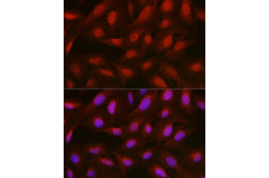 Immunofluorescence - Anti-Annexin A1/ANXA1 Antibody (A8466) - Antibodies.com