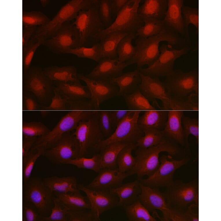 Immunofluorescence - Anti-Annexin A1/ANXA1 Antibody (A8466) - Antibodies.com