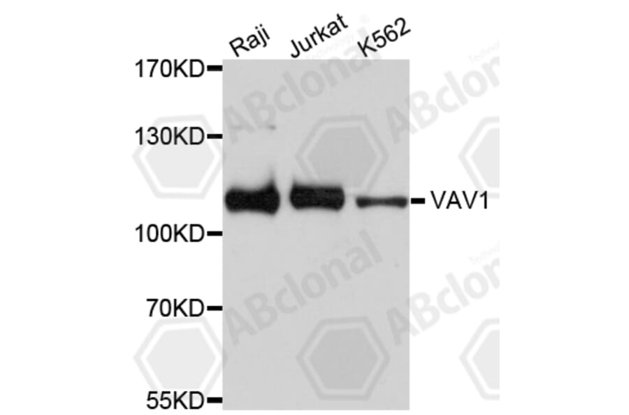 Western Blot - Anti-VAV1 Antibody (A0770) - Antibodies.com