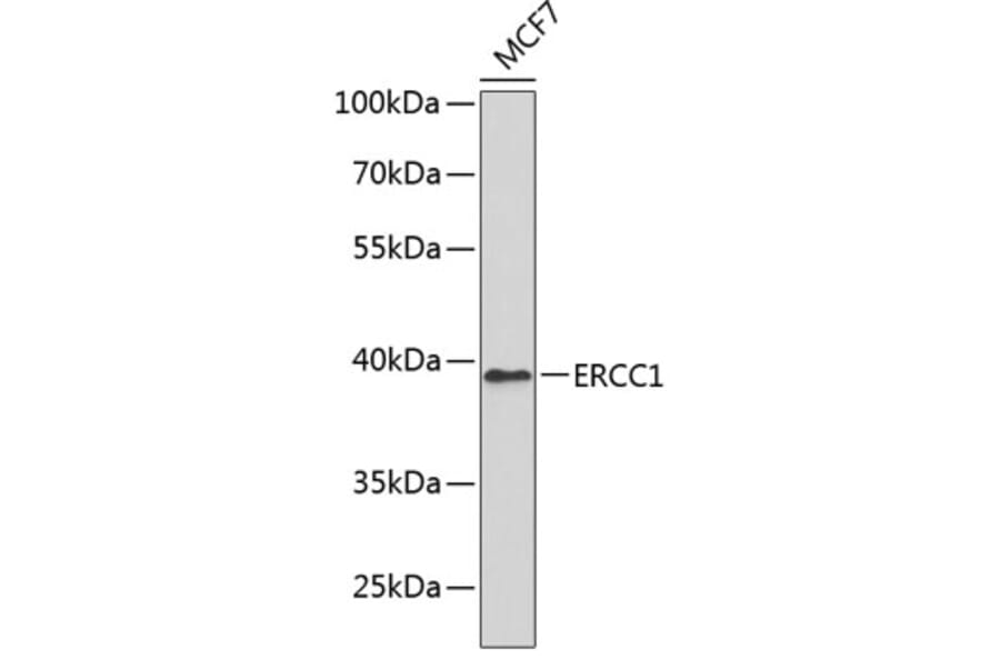 Western Blot - Anti-ERCC1 Antibody (A0777) - Antibodies.com
