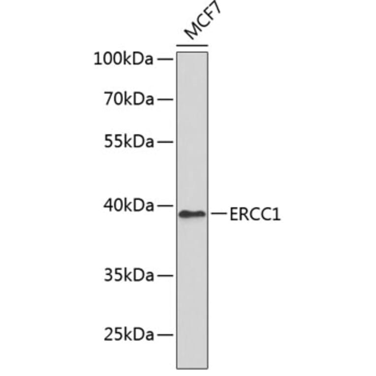 Western Blot - Anti-ERCC1 Antibody (A0777) - Antibodies.com