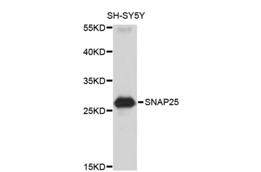 Western Blot - Anti-SNAP25 Antibody (A0795) - Antibodies.com