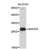 Western Blot - Anti-SNAP25 Antibody (A0795) - Antibodies.com
