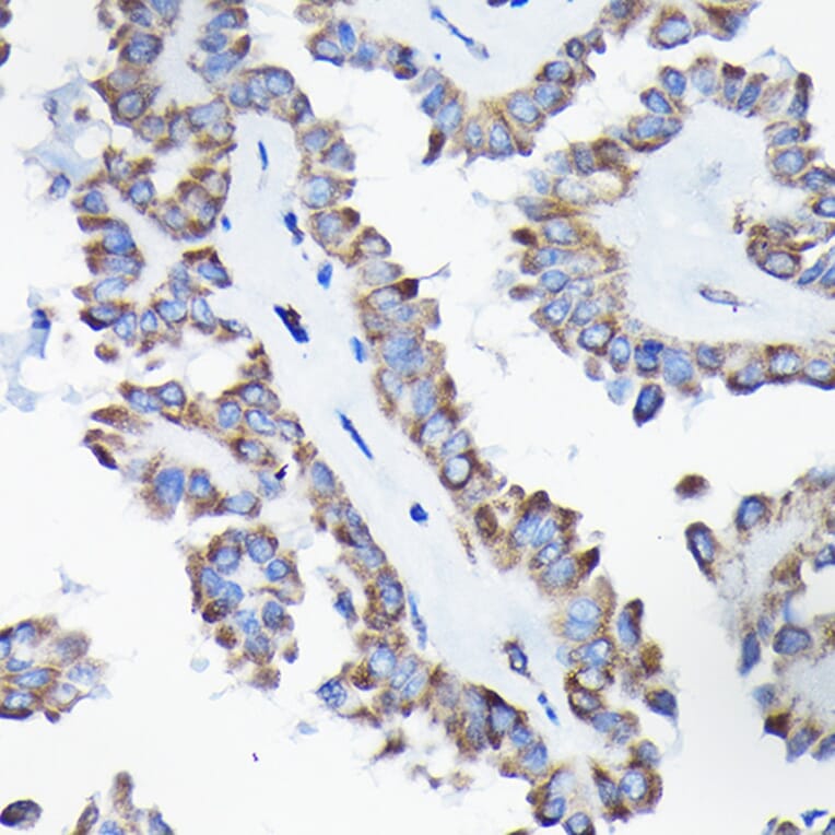 Immunohistochemistry - Anti-AIF Antibody (A8473) - Antibodies.com