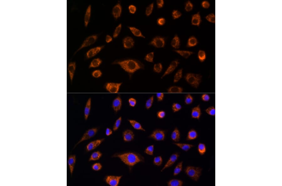 Immunofluorescence - Anti-AIF Antibody (A8473) - Antibodies.com