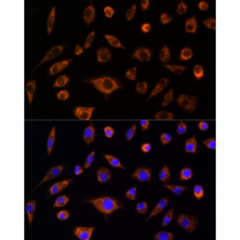 Immunofluorescence - Anti-AIF Antibody (A8473) - Antibodies.com