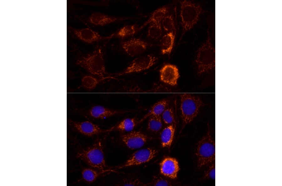 Immunofluorescence - Anti-AIF Antibody (A8473) - Antibodies.com