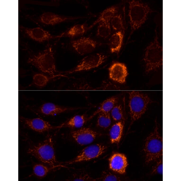 Immunofluorescence - Anti-AIF Antibody (A8473) - Antibodies.com