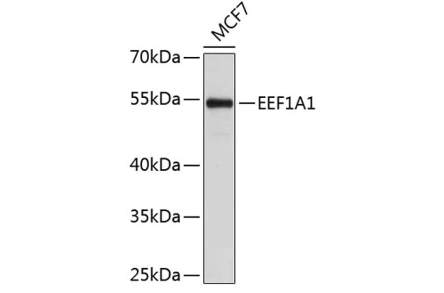 Western Blot - Anti-EEF1A1 Antibody (A0831) - Antibodies.com
