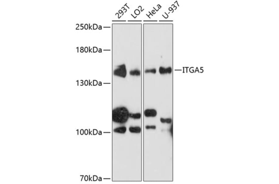 Western Blot - Anti-ITGA5 Antibody (A0832) - Antibodies.com