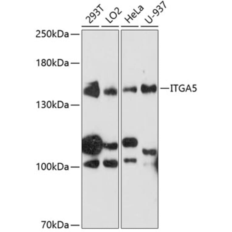 Western Blot - Anti-ITGA5 Antibody (A0832) - Antibodies.com