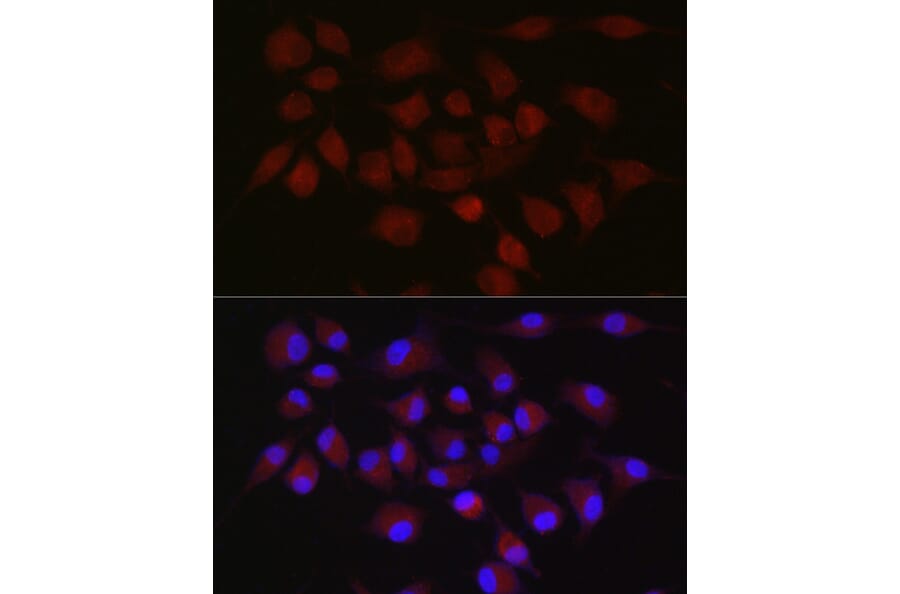 Immunofluorescence - Anti-cIAP2 Antibody (A8479) - Antibodies.com