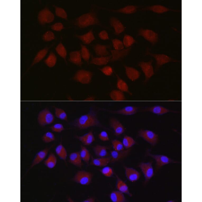 Immunofluorescence - Anti-cIAP2 Antibody (A8479) - Antibodies.com