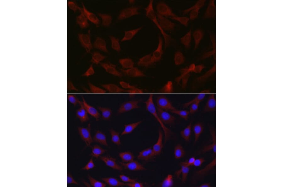 Immunofluorescence - Anti-cIAP2 Antibody (A8479) - Antibodies.com