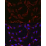 Immunofluorescence - Anti-cIAP2 Antibody (A8479) - Antibodies.com