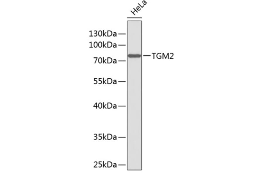 Western Blot - Anti-TGM2 Antibody (A0840) - Antibodies.com