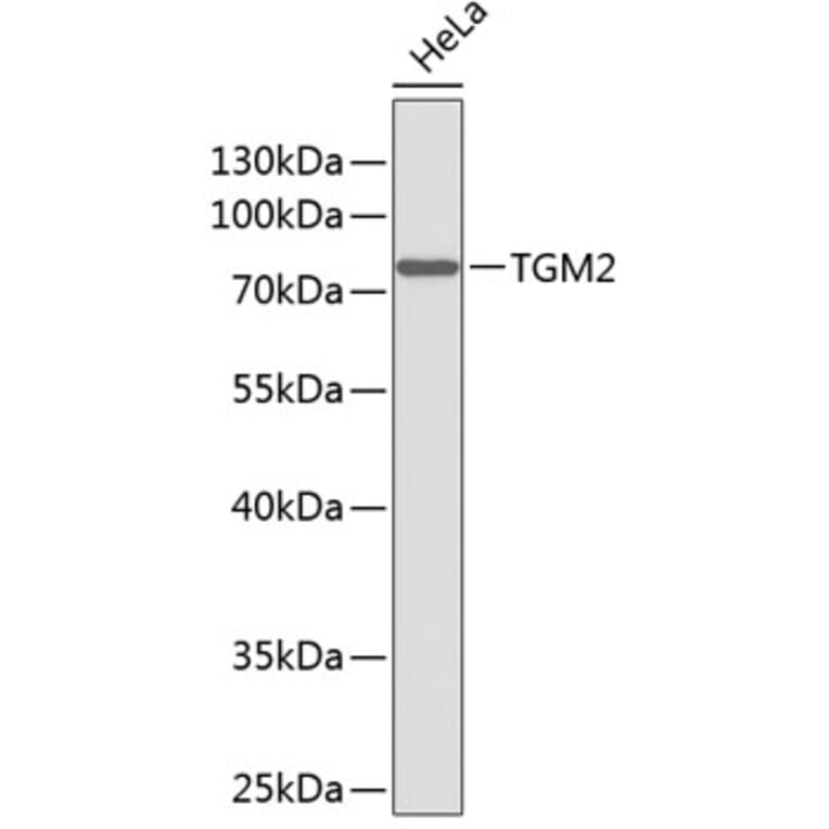 Western Blot - Anti-TGM2 Antibody (A0840) - Antibodies.com