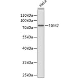 Western Blot - Anti-TGM2 Antibody (A0840) - Antibodies.com