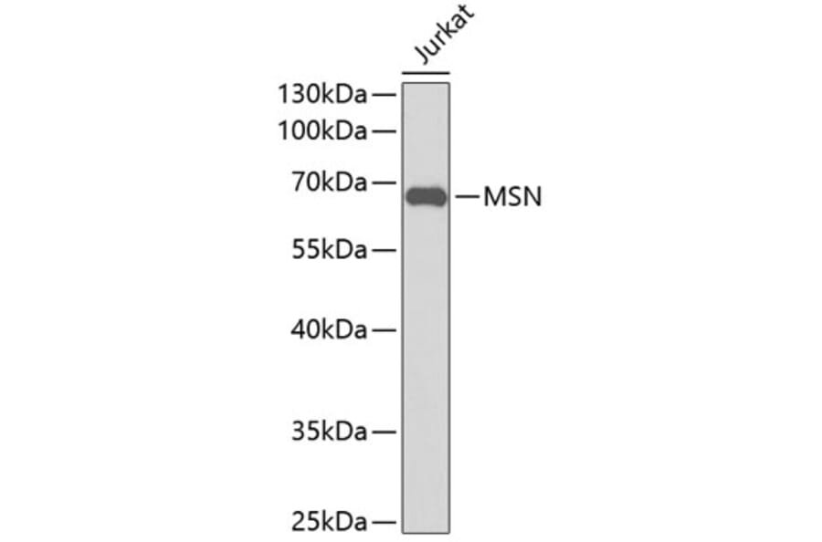 Western Blot - Anti-MSN Antibody (A0847) - Antibodies.com