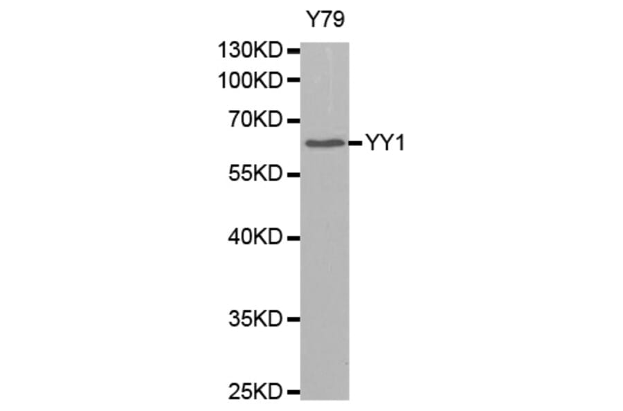 Western Blot - Anti-YY1 Antibody (A0856) - Antibodies.com