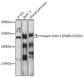 Western Blot - Anti-Integrin beta 4 Antibody (A8487) - Antibodies.com