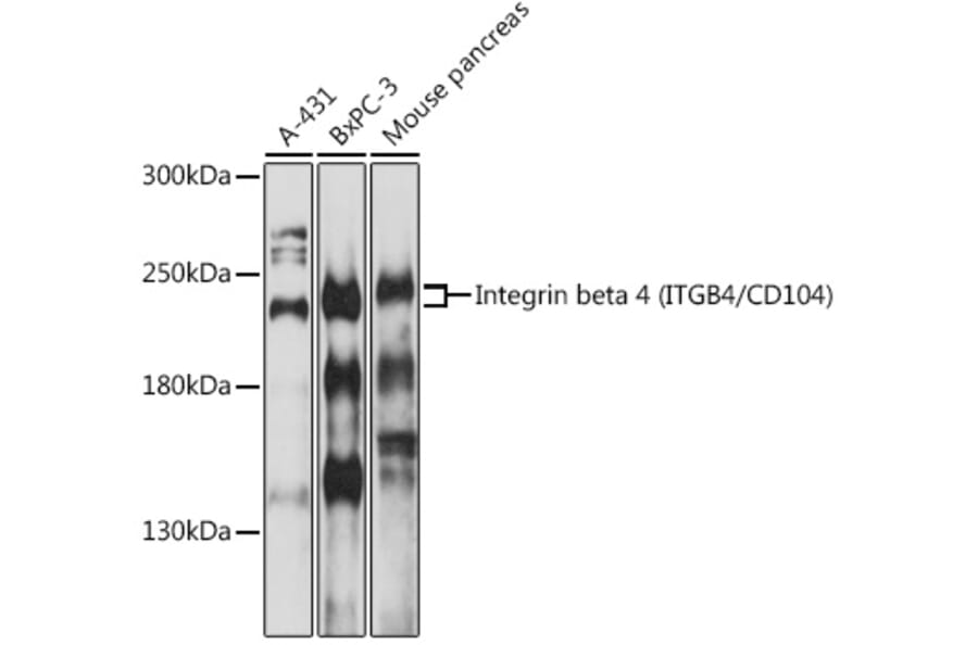 Western Blot - Anti-Integrin beta 4 Antibody (A8487) - Antibodies.com