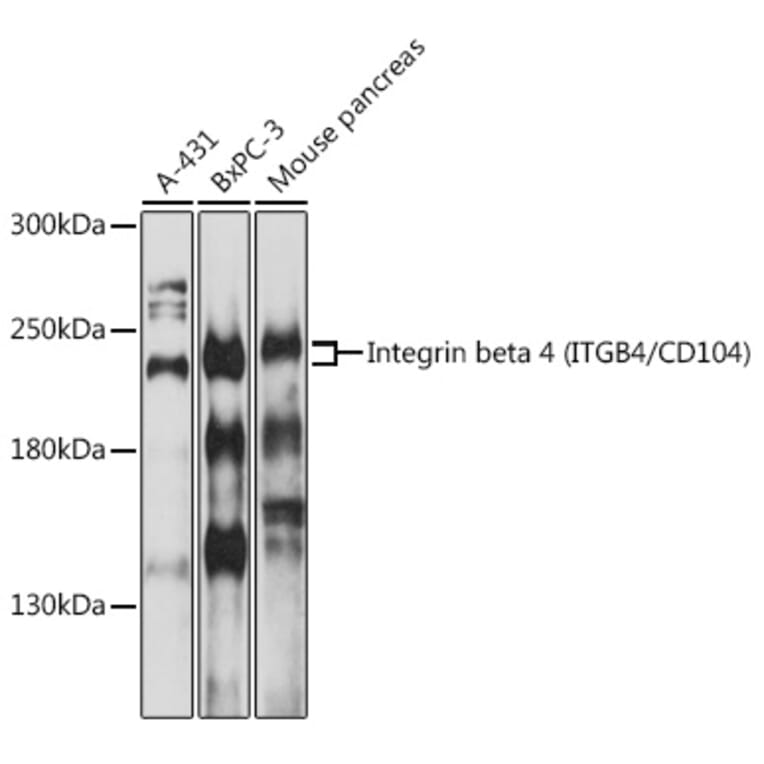Western Blot - Anti-Integrin beta 4 Antibody (A8487) - Antibodies.com