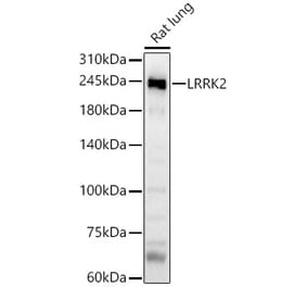 Western Blot - Anti-LRRK2 Antibody (A8488) - Antibodies.com