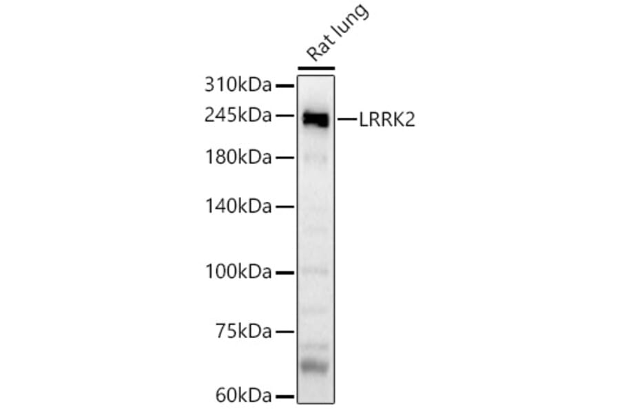 Western Blot - Anti-LRRK2 Antibody (A8488) - Antibodies.com