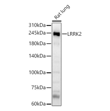 Western Blot - Anti-LRRK2 Antibody (A8488) - Antibodies.com