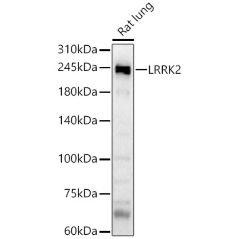 Western Blot - Anti-LRRK2 Antibody (A8488) - Antibodies.com