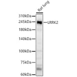 Western Blot - Anti-LRRK2 Antibody (A8488) - Antibodies.com