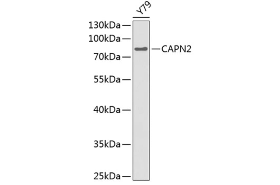 Western Blot - Anti-CAPN2 Antibody (A0900) - Antibodies.com