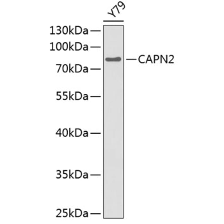 Western Blot - Anti-CAPN2 Antibody (A0900) - Antibodies.com