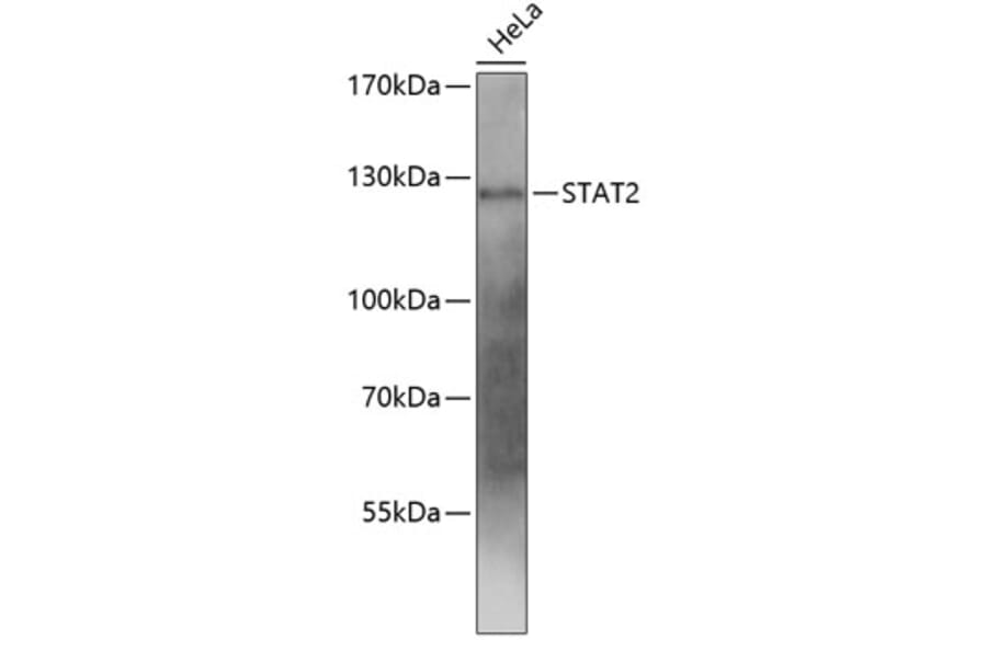 Western Blot - Anti-STAT2 Antibody (A0913) - Antibodies.com