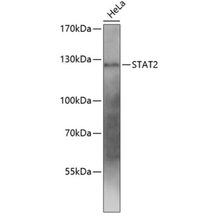 Western Blot - Anti-STAT2 Antibody (A0913) - Antibodies.com