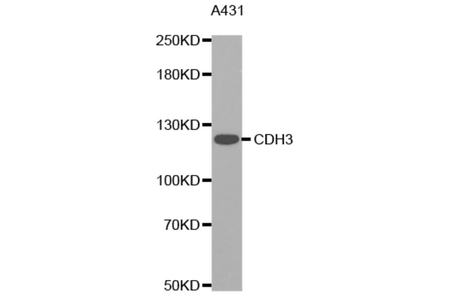 Western Blot - Anti-CDH3 Antibody (A0915) - Antibodies.com