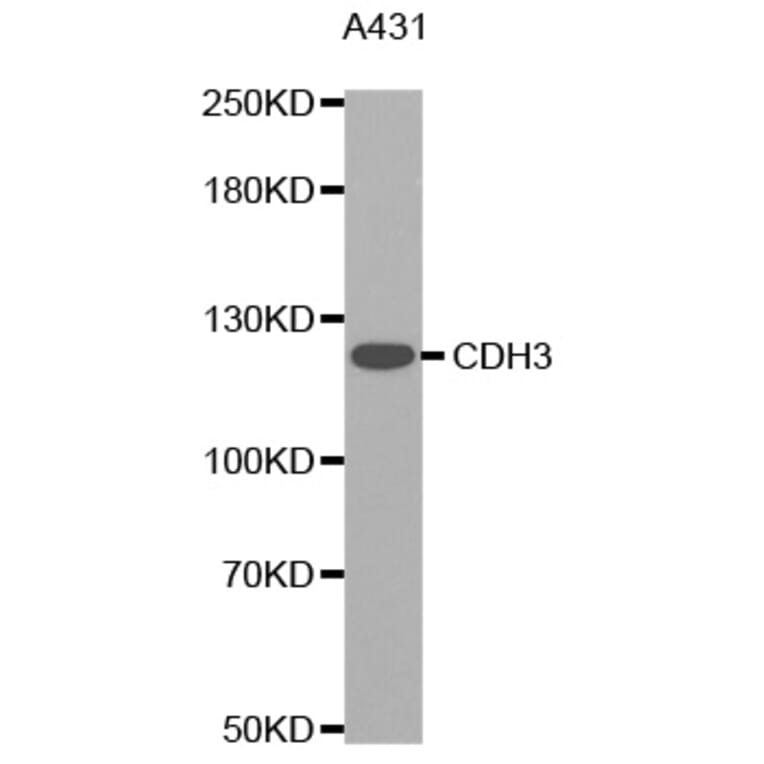 Western Blot - Anti-CDH3 Antibody (A0915) - Antibodies.com
