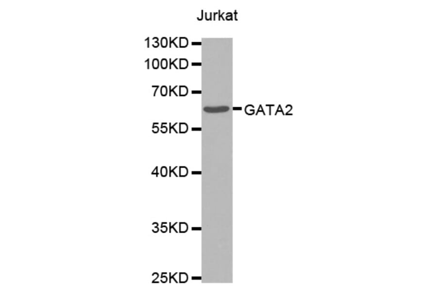 Western Blot - Anti-GATA2 Antibody (A0916) - Antibodies.com