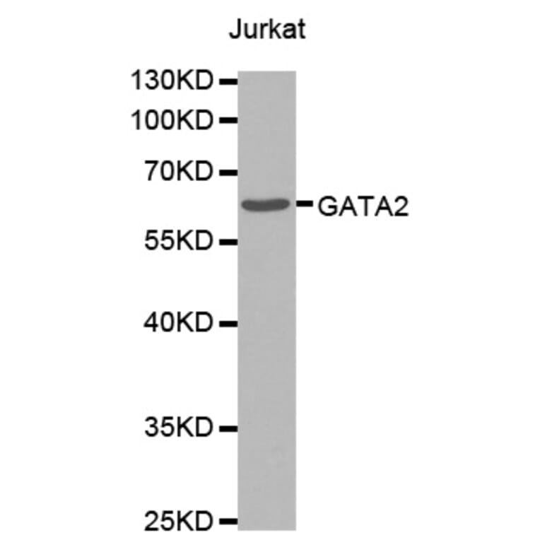 Western Blot - Anti-GATA2 Antibody (A0916) - Antibodies.com